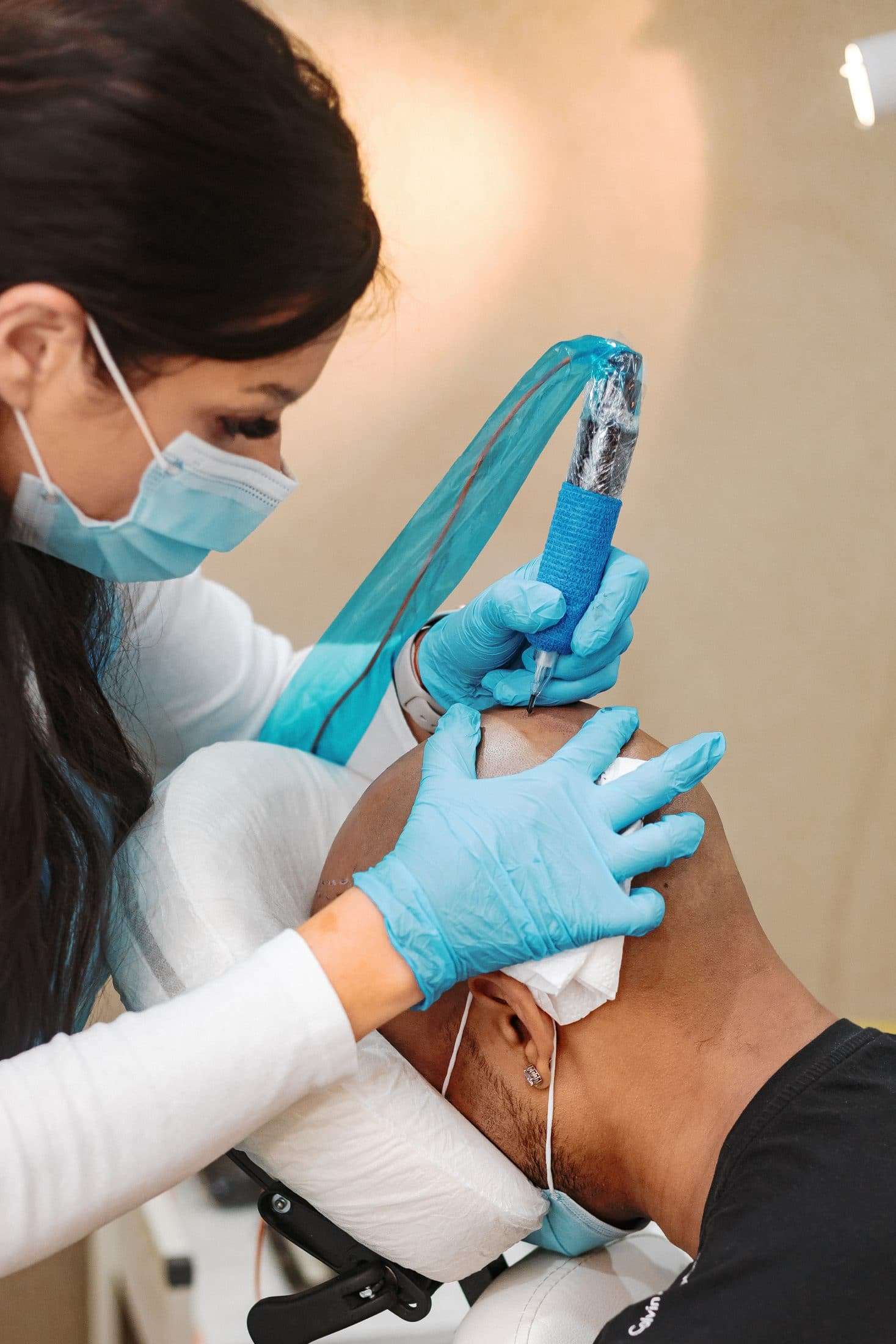 Scalp micropigmentation treatment being performed on a man with hair loss